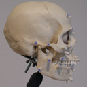 White Female Skull